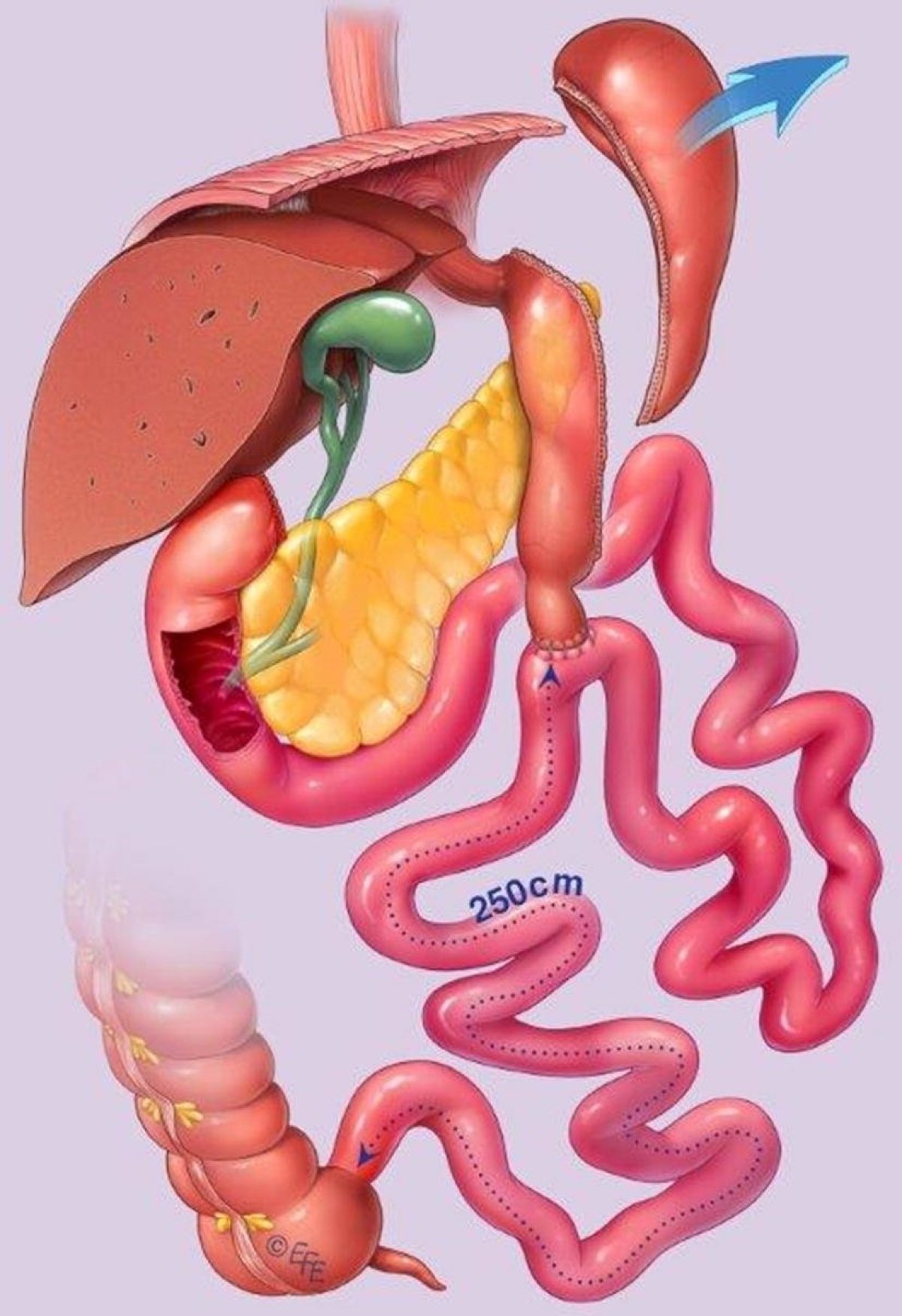 تجاوز SADI